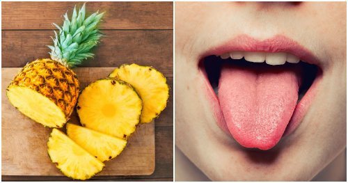 Pineapple allergy: Symptoms, treatment, and cross-reactivity