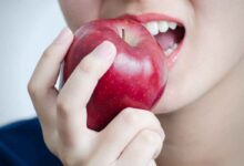 Are Apples Good For Headaches