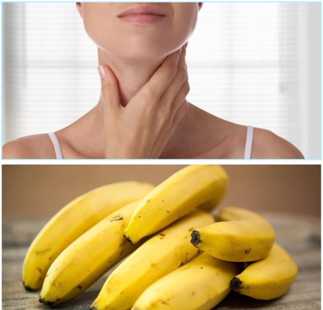 Thyroid-Friendly Fruit: Is Banana Good for Hyperthyroidism?