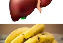 are Bananas Good or Bad for Your Liver