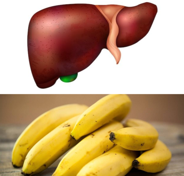 are Bananas Good or Bad for Your Liver