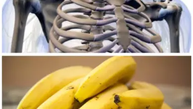 Are Bananas Good For Osteoporosis