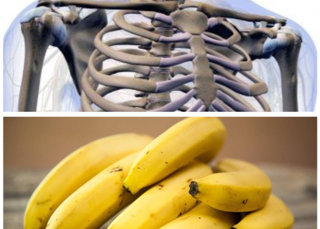 Are Bananas Good For Osteoporosis